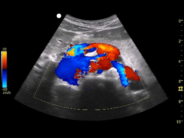 Color doppler ultrasound image depicting the value of ultrasound imaging for diagnostic purposes