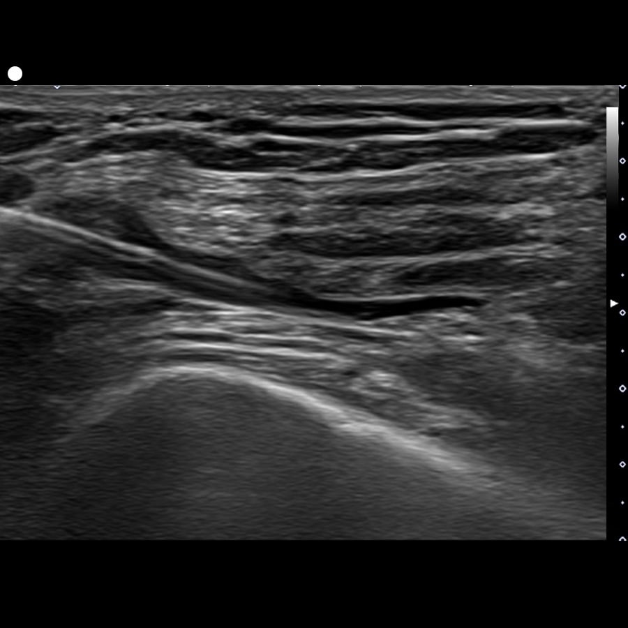 20230525_LN_InjDryKnee3_01