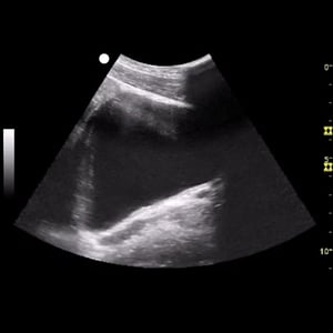 41lx4gwa35an-prostate_technique_pearls_26