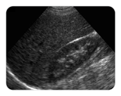 Ultrasound image depicting abdomen content for diagnostic medical sonography programs
