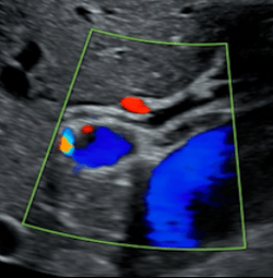 Abdomen- Biliary Protocol