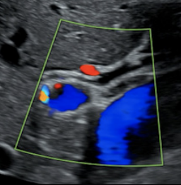 Abdomen- Biliary Protocol