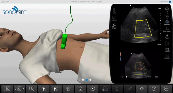 Abdomen-Challenge-Case-10---CFD
