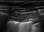 Anesthesiology critical care ultrasound image
