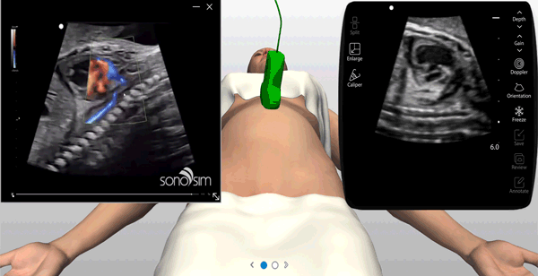 Ultrasound experts narrate key findings while learners simulate ultrasound scanning Ultrasound experts narrate key findings while learners simulate ultrasound scanning