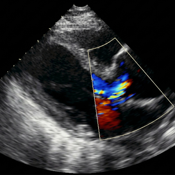Cardiac Resuscitation2