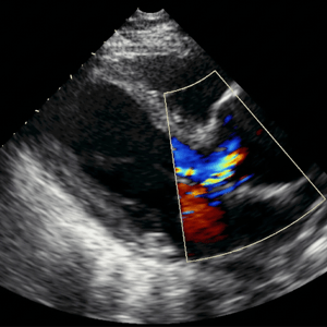 Cardiac Resuscitation2 Cardiac Resuscitation2