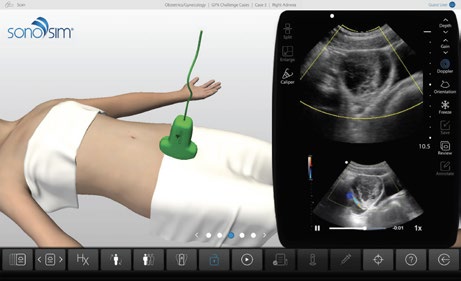 Challenge cases contain real ultrasound videos from real patients