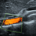 DMS Abdominal Aorta Protocol