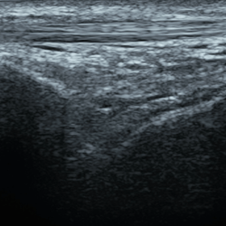 DMS_Anterior_Ankle