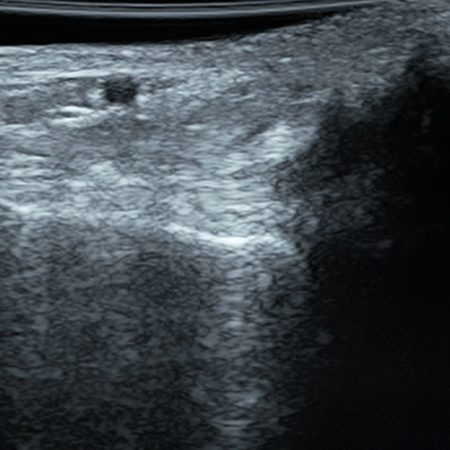 DMS_Lateral_Ankle