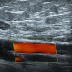 DMS Lower Extremity Arterial