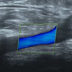 DMS Lower Extremity Venous