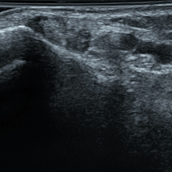 DMS_Medial_Ankle