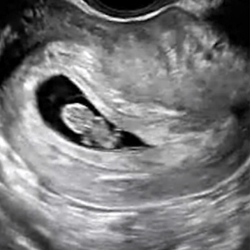 DMS_Standard_First_Trimester_Protocol