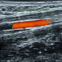 DMS Upper Extremity Arterial Protocol