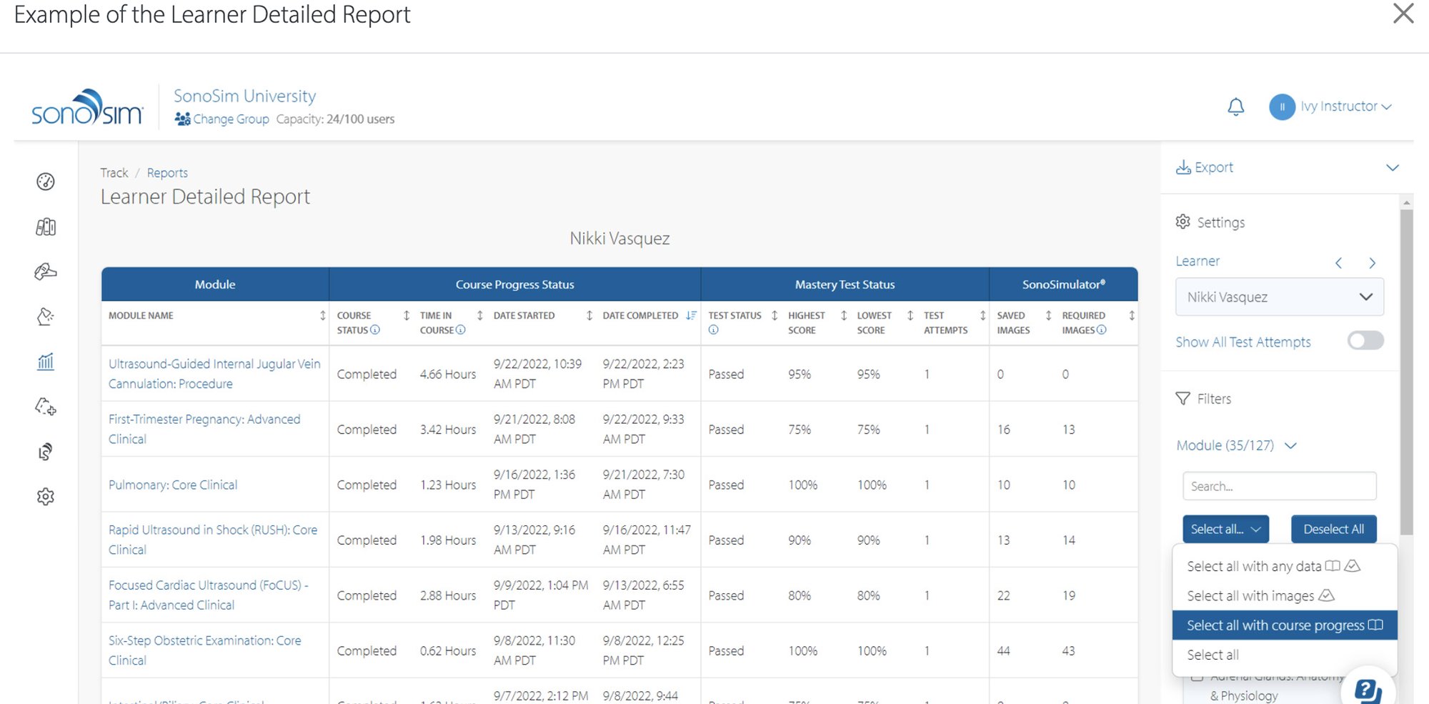 SonoSim Performance Tracker contains detailed reports as shown