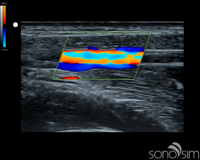 September 2025 - Sonography Special