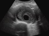 Emergency medicine ultrasound image