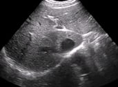 Family medicine ultrasound image