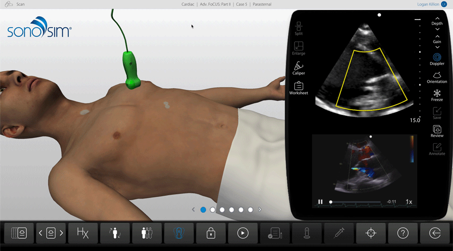 Cardiac Sonography: SonoSimulator scanning through Cardiac Advanced FoCUS with color flow doppler on screen