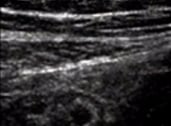 General surgery ultrasound image