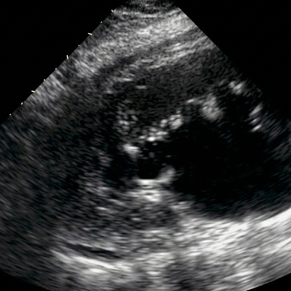 Genitourinary-1