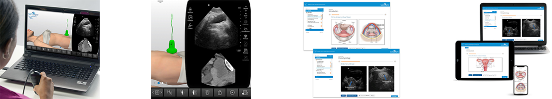 OB GYN Ultrasound Training
