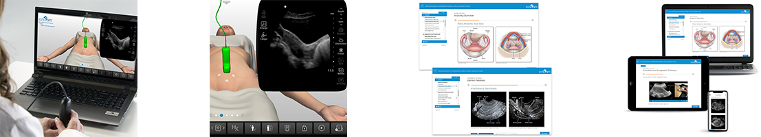 Non-pregnant Uterus Ultrasound Scanning