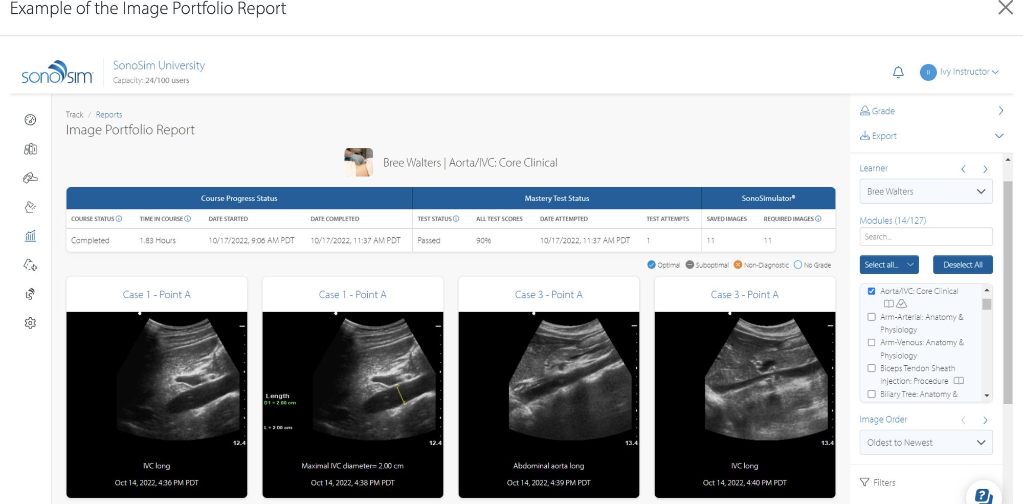 SonoSim Performance Tracker contains image reports as shown