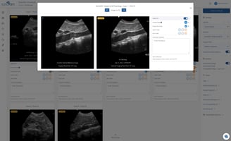 image-comparison-aia