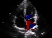 Internal medicine ultrasound image