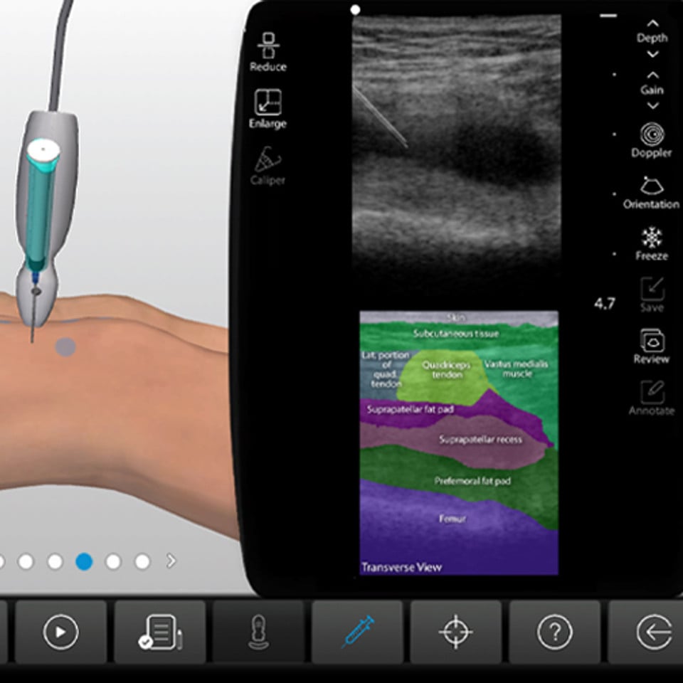 Knee_Joint_IA_Cropped_Case_Screen__81221-1