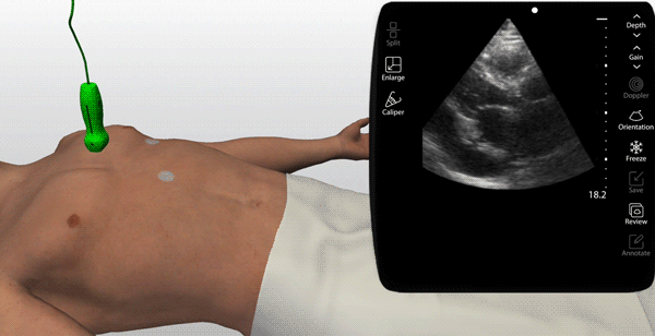 Learn ultrasound imaging with access to thousands of real patient pathologies Learn ultrasound imaging with access to thousands of real patient pathologies