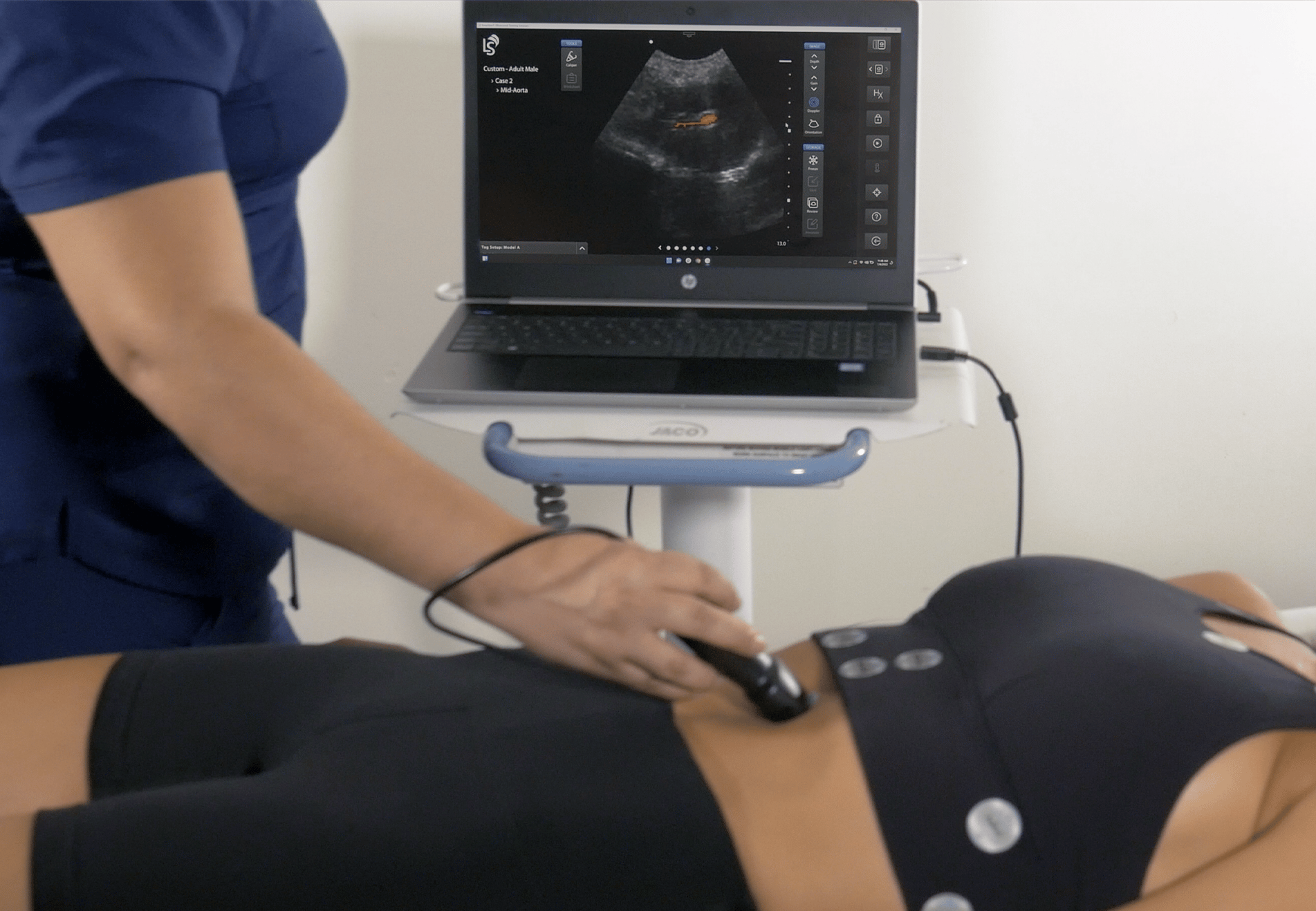 Ultrasound Simulation Training - Simulation Centers - SonoSim