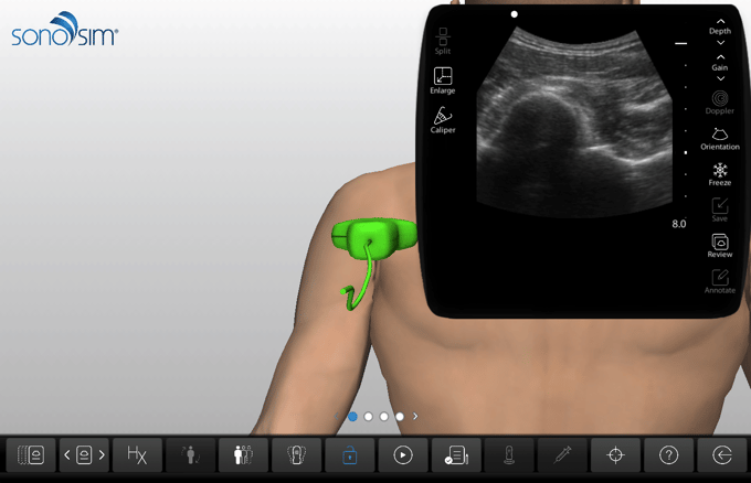 MSK Challenge Case 14