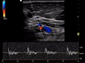 Medical school specialty ultrasound image