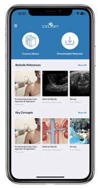 SonoSim mobile app is ideal for ultrasound training and study tools on the go