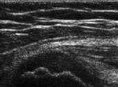 Orthopedic ultrasound image