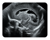 Pediatric sonography image for diagnostic medical sonography training