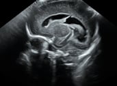 Pediatric ultrasound image