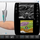 Introduction to Ultrasound-Guided Regional Anesthesia