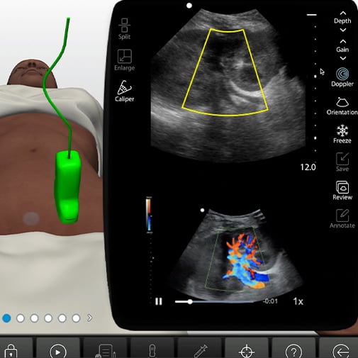 Renal Transplant Screen Renal Transplant Screen