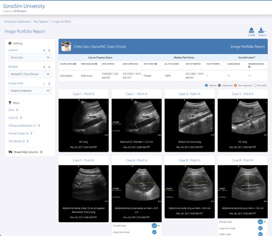 Reviewing POCUS image submissions as an instructor is made easy with Performance Tracker