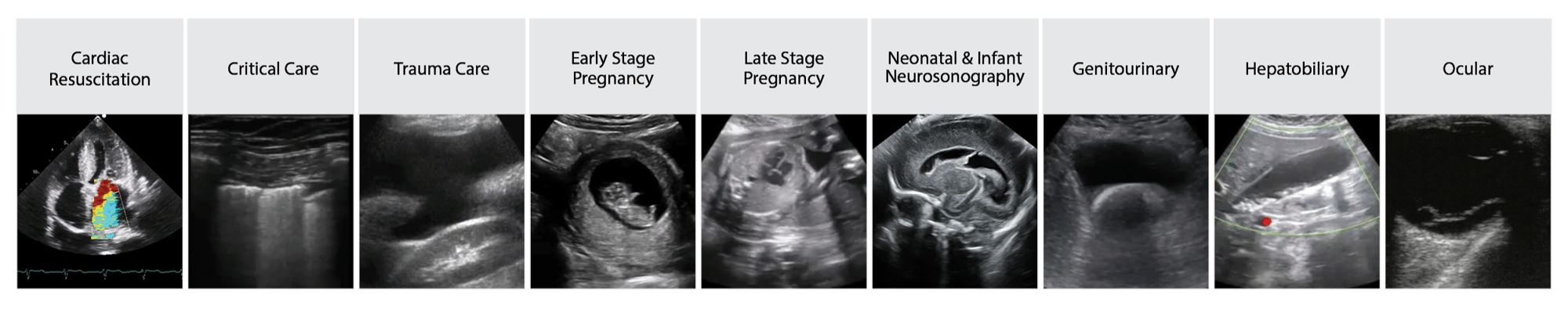 Variety of ultrasound images depicting ultrasound applications that are ideal to teach in a simulation center