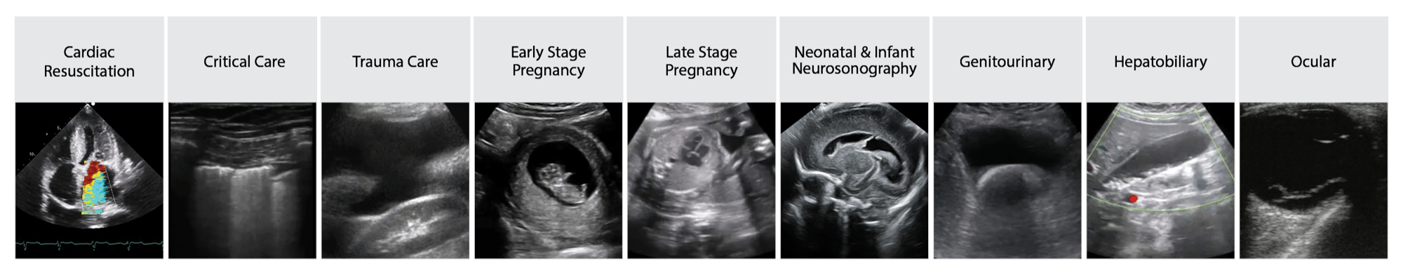 Over 1 million unique ultrasound simulation scenarios