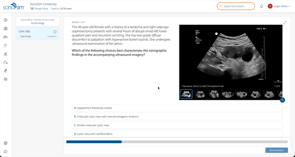 SonoSim-Upates-Aug-2026.1
