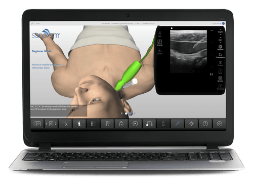 SonoSim user interface shown on a personal computer