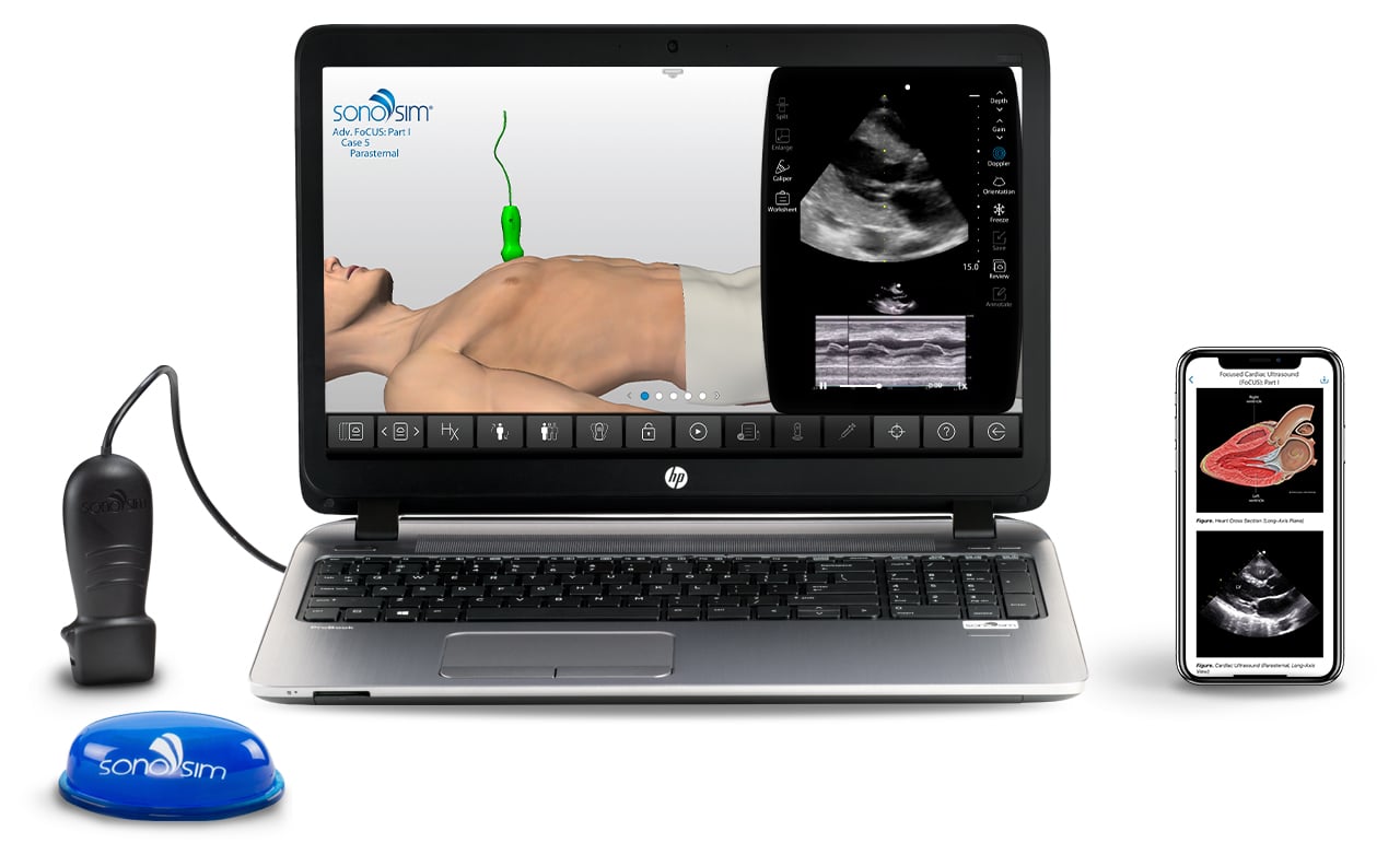 SonoSim user interface shown on a laptop and mobile device