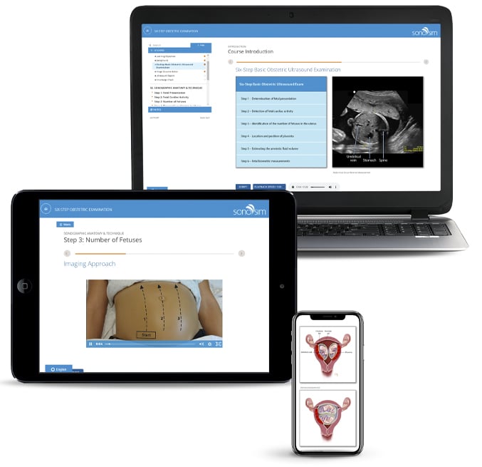 SonoSim courses shown on a laptop, tablet, and mobile device for POCUS training anytime, anywhere
